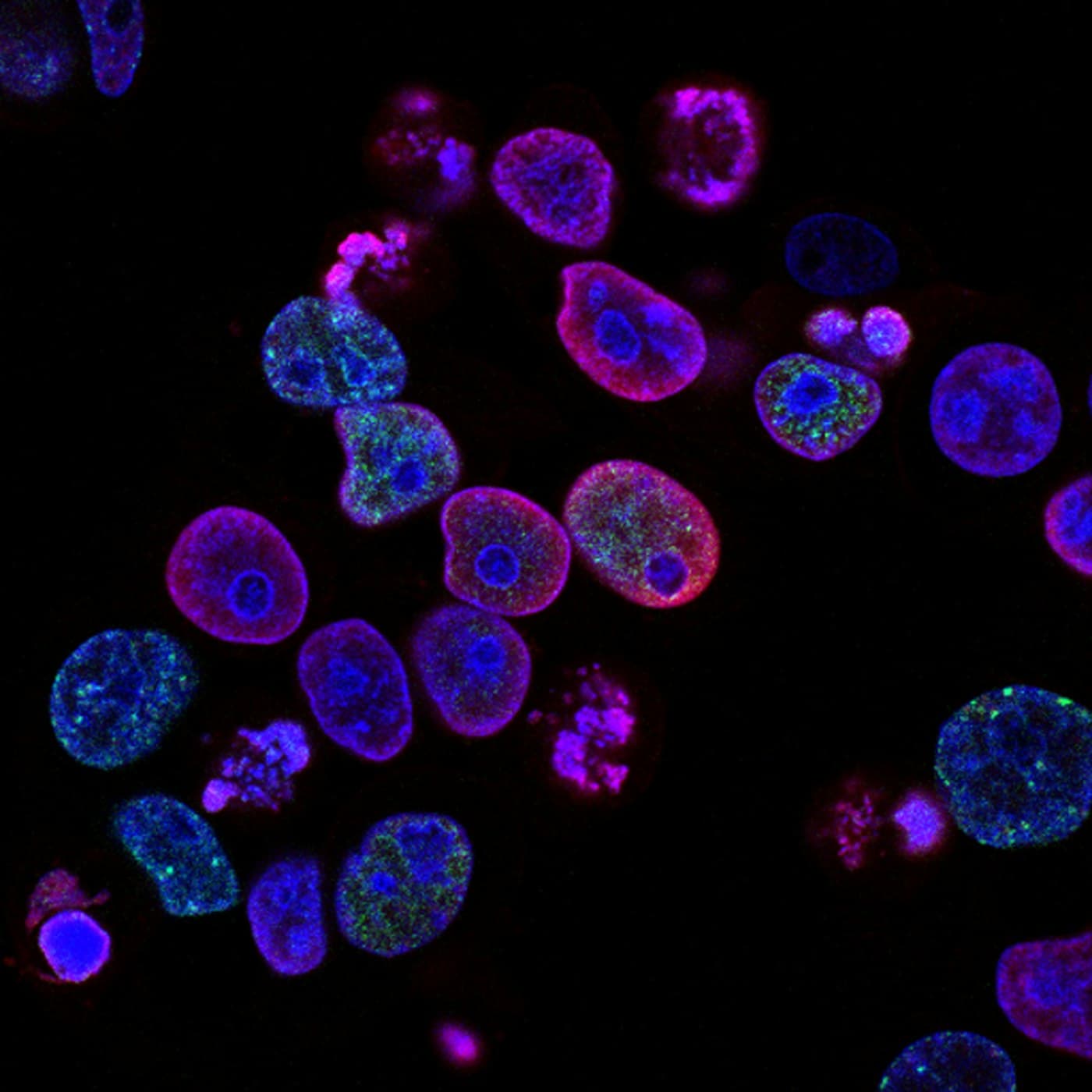 Fluorescence microscopy imagery